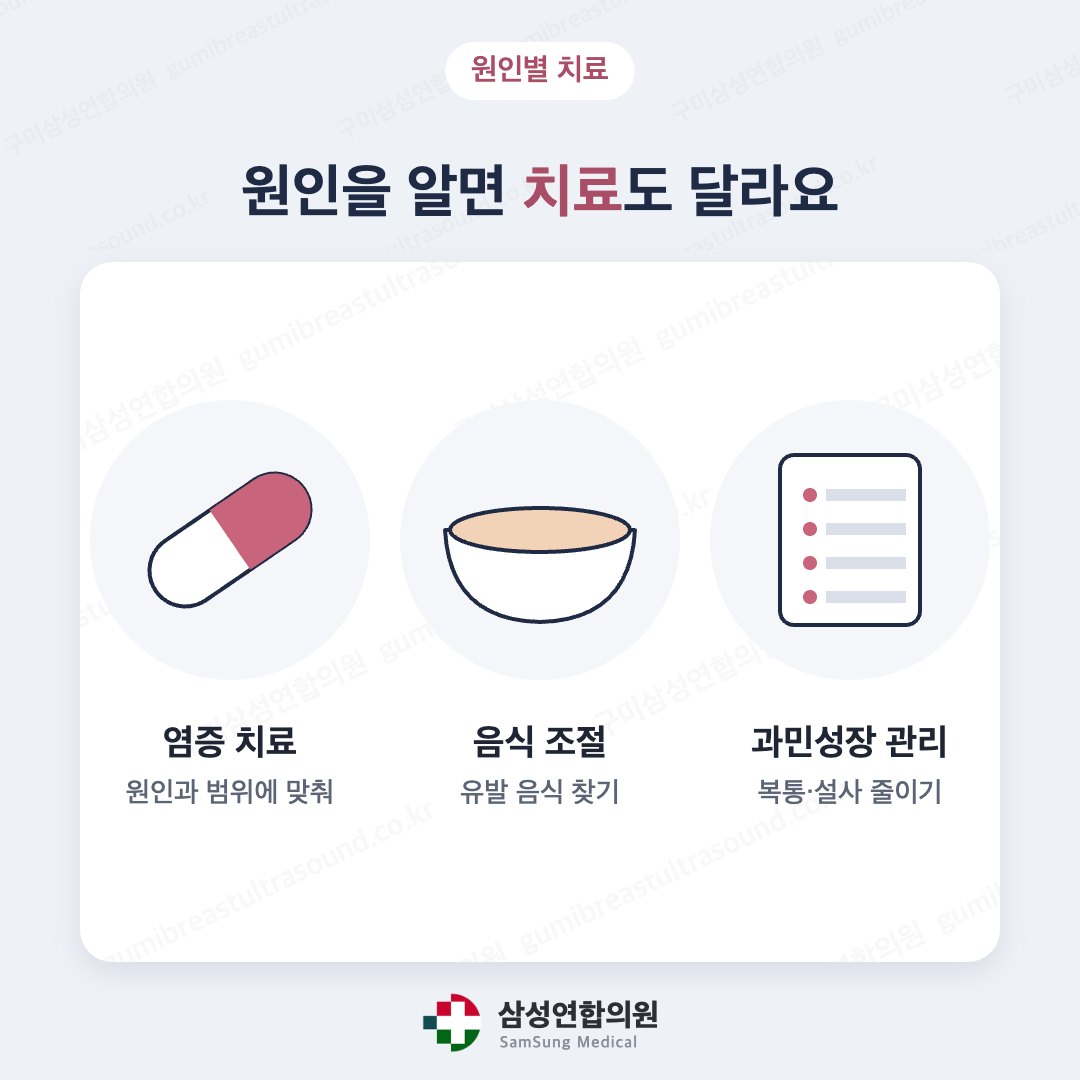 장 염증 약물치료, 음식 조절, 과민성장증후군 관리를 나타낸 의학 도식