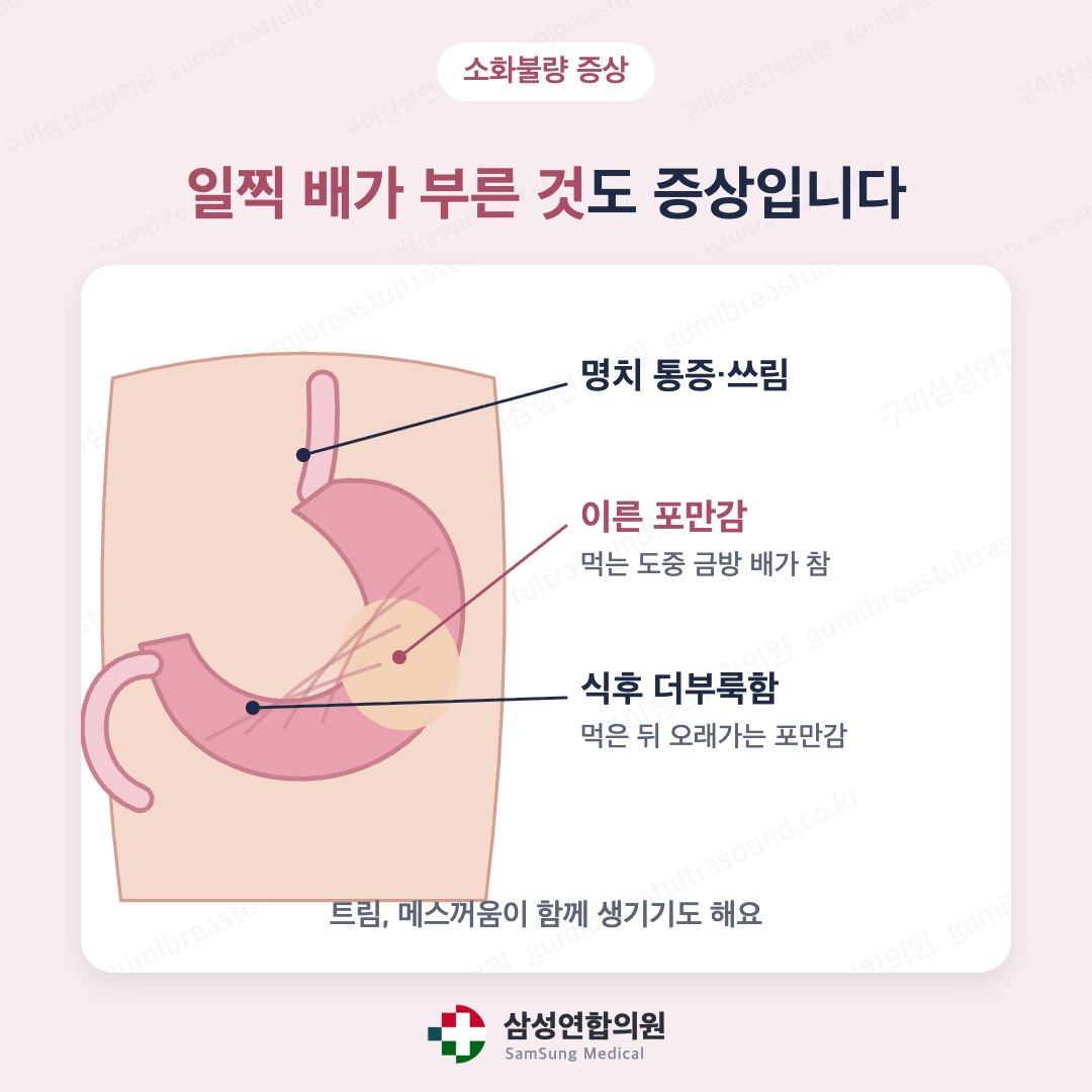 명치 통증, 이른 포만감, 식후 더부룩함, 트림과 메스꺼움 등 소화불량 증상을 나타낸 의학 도식