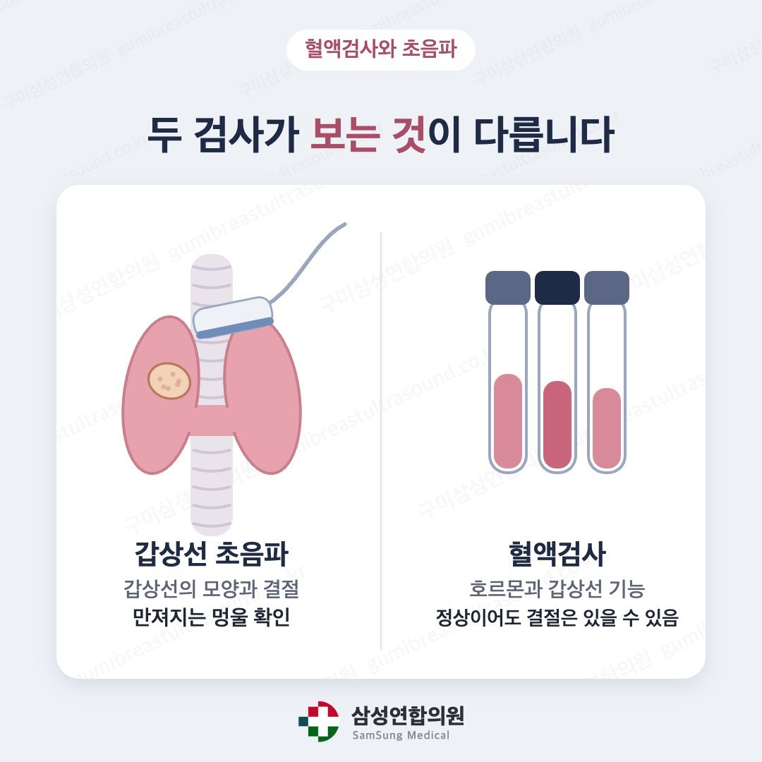 갑상선 초음파와 혈액검사가 확인하는 내용을 비교한 의학 도식