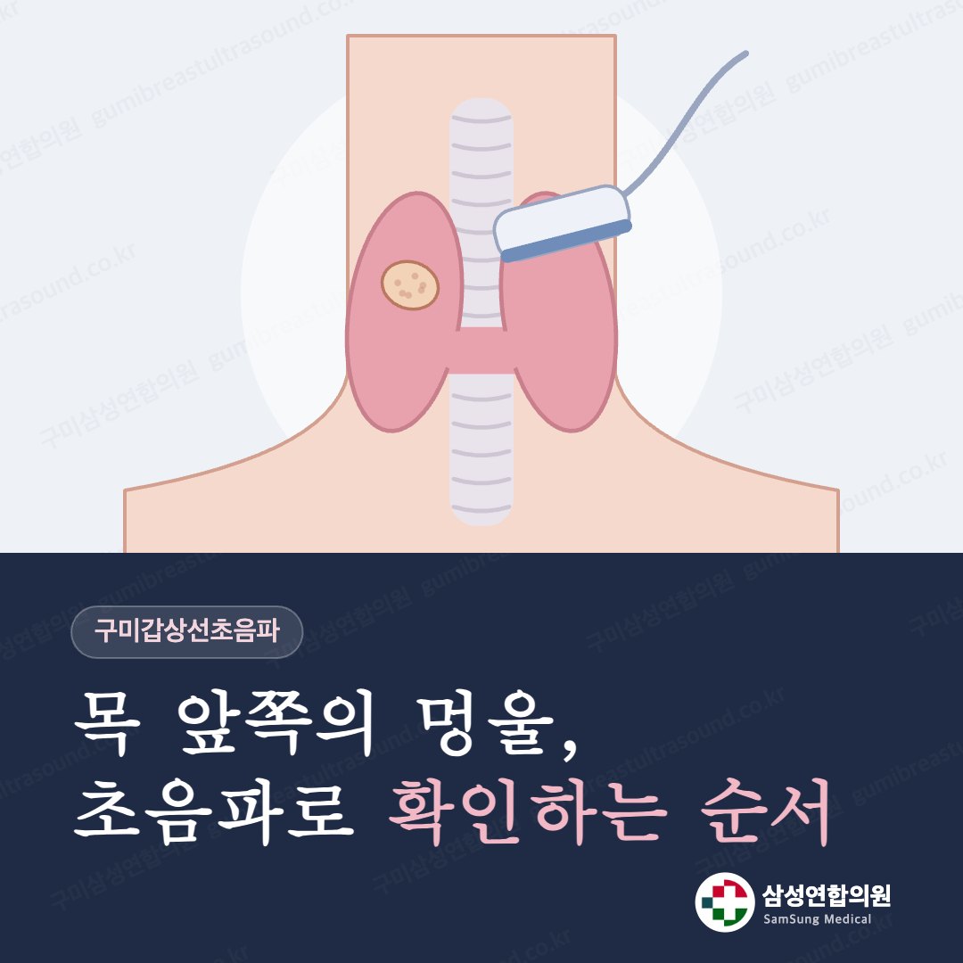 구미 갑상선 초음파, 목 앞쪽에 멍울이 만져진다면