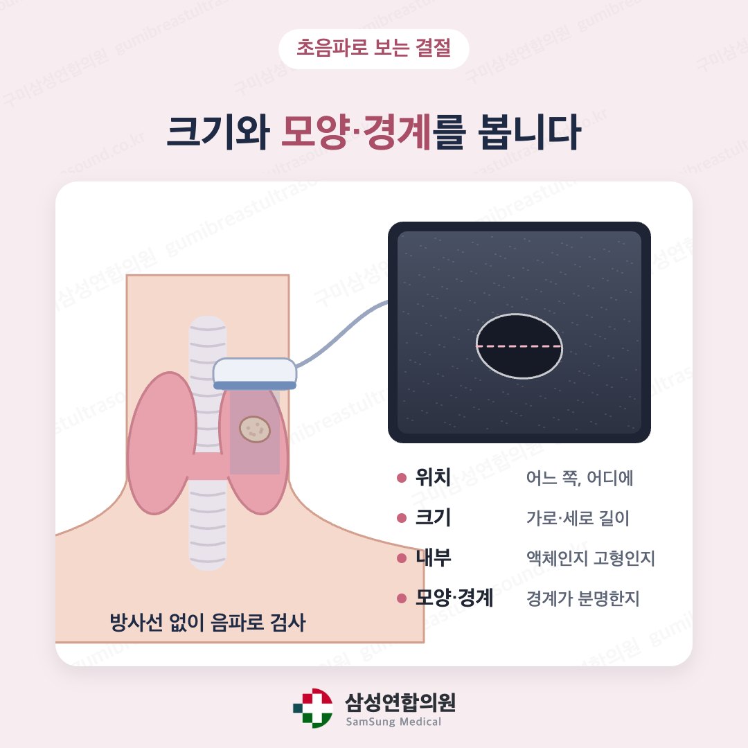 목에 탐촉자를 대고 결절의 위치·크기·내부·경계를 보는 갑상선 초음파 도식